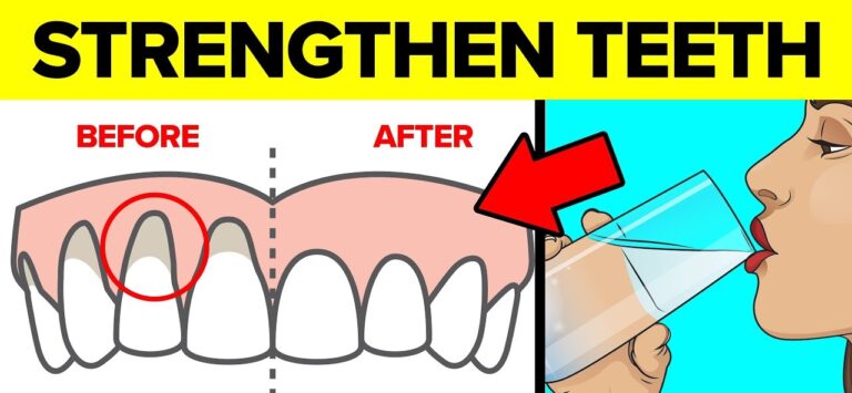 strength-teeth